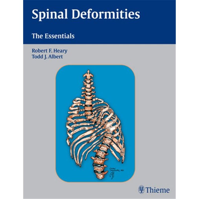Spinal Deformities - The Essentials